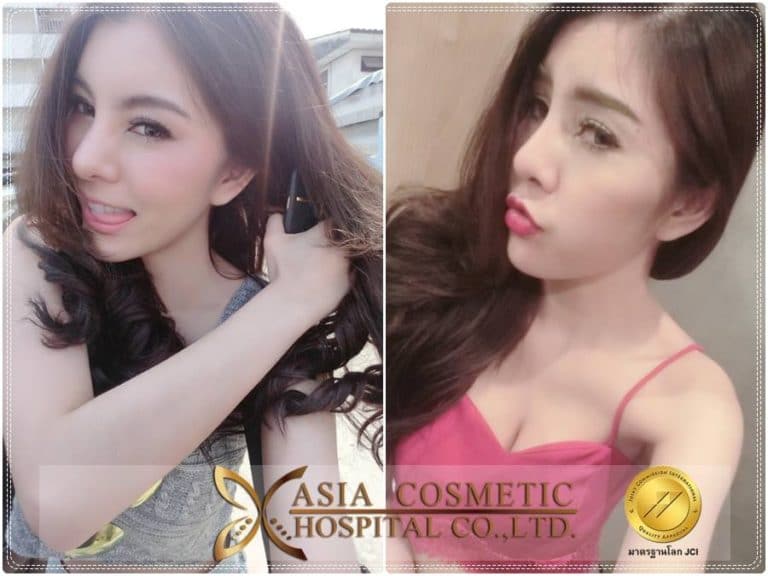แก้จมูก