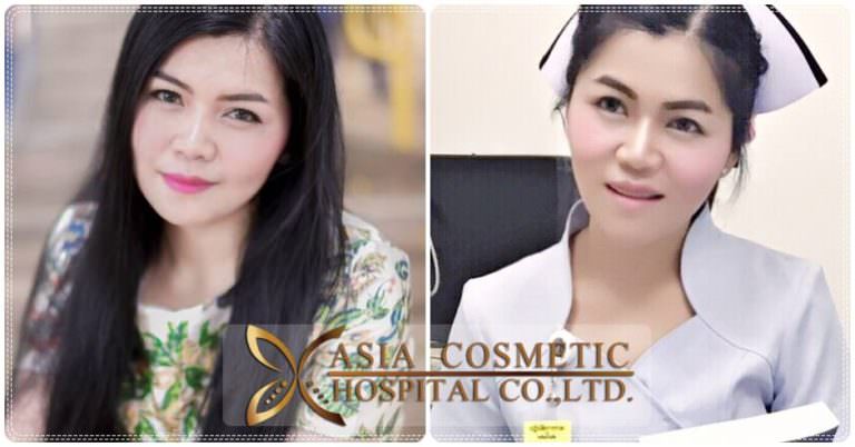 เสริมคางรีวิวทำคาง