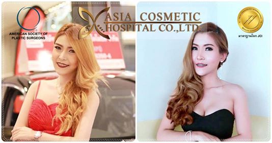 เสริมหน้าอกเมนเตอร์ 400cc