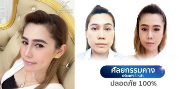 ปรับแต่งใบหน้า ด้วยการศัลยกรรมคาง