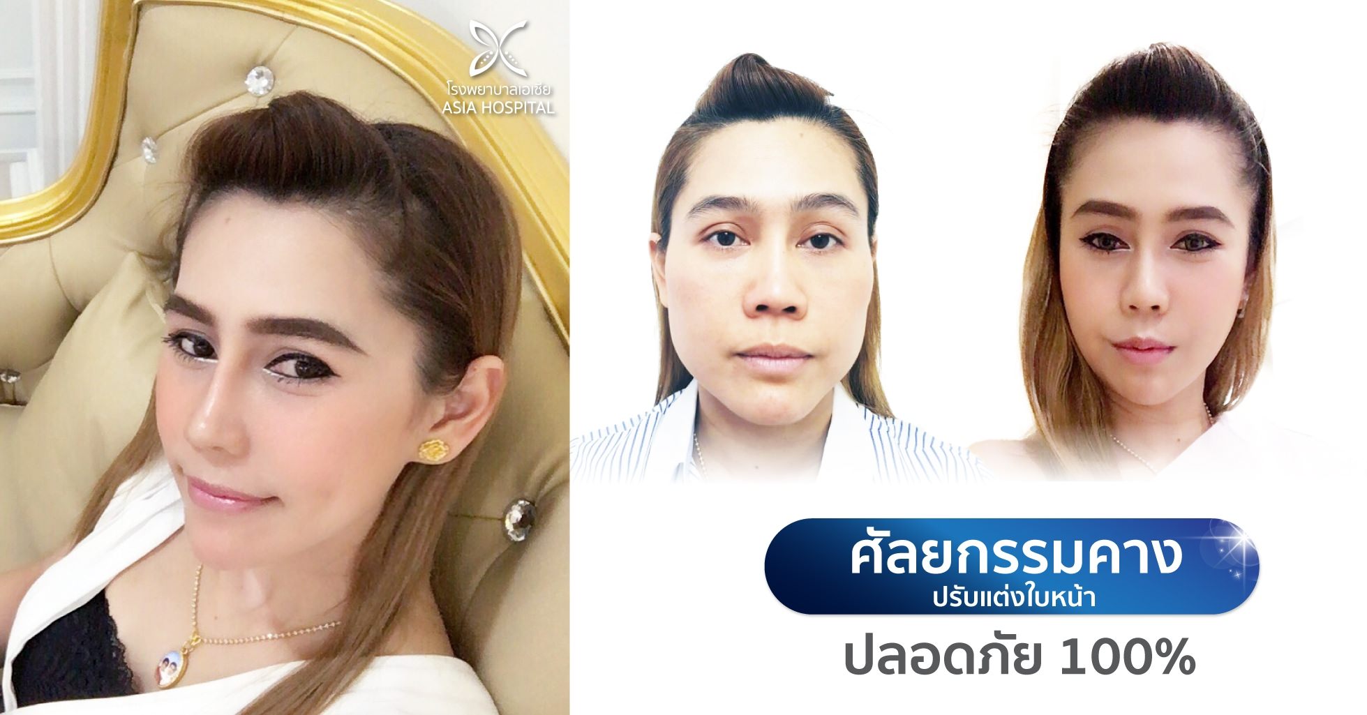 ศัลยกรรมคาง