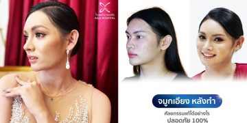 จมูกเอียง หลังทำศัลยกรรม แก้ไขอย่างไรดี