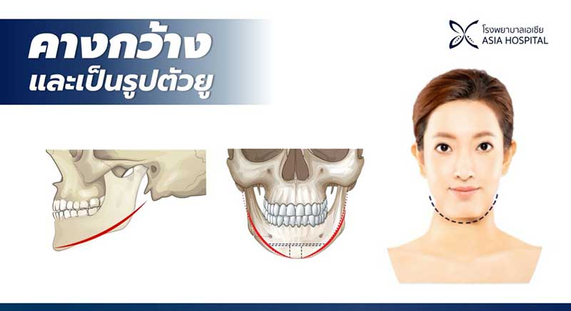 คางกว้าง-วีไลน์