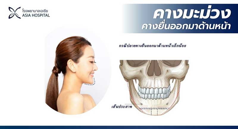 คางมะม่วง-วีไลน์