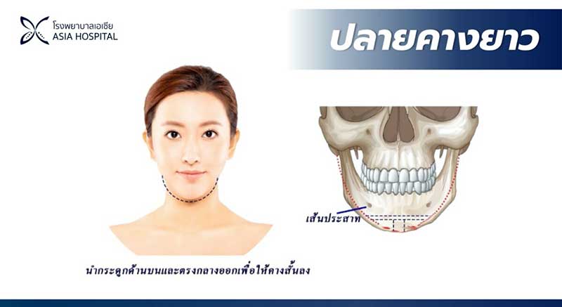 คางยาว