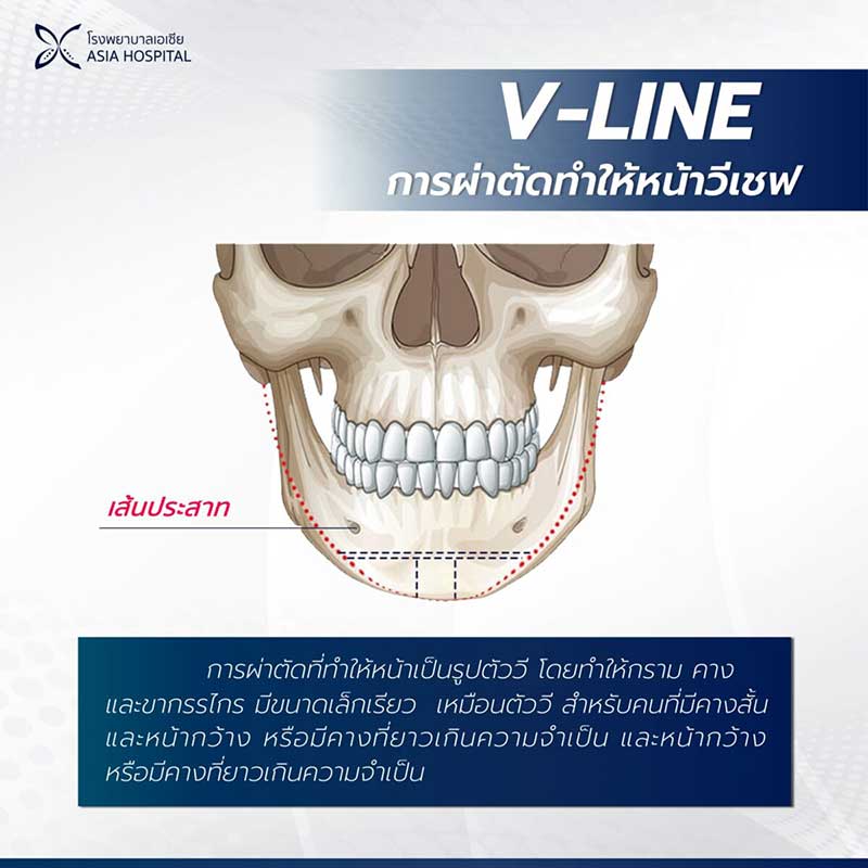 วีไลน์-V-line