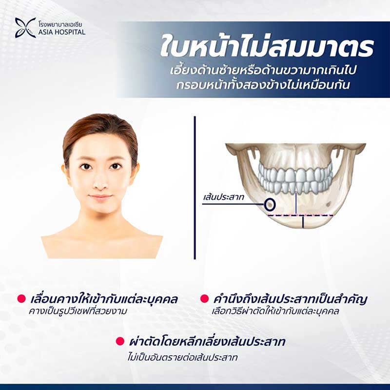 ใบหน้าไม่สมมาตร-v-line