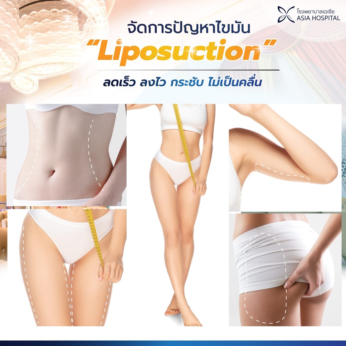ดูดไขมัน-ยกกระชับ
