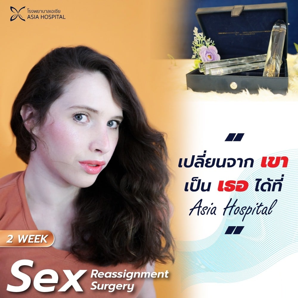 ผ่าตัดแปลงเพศ