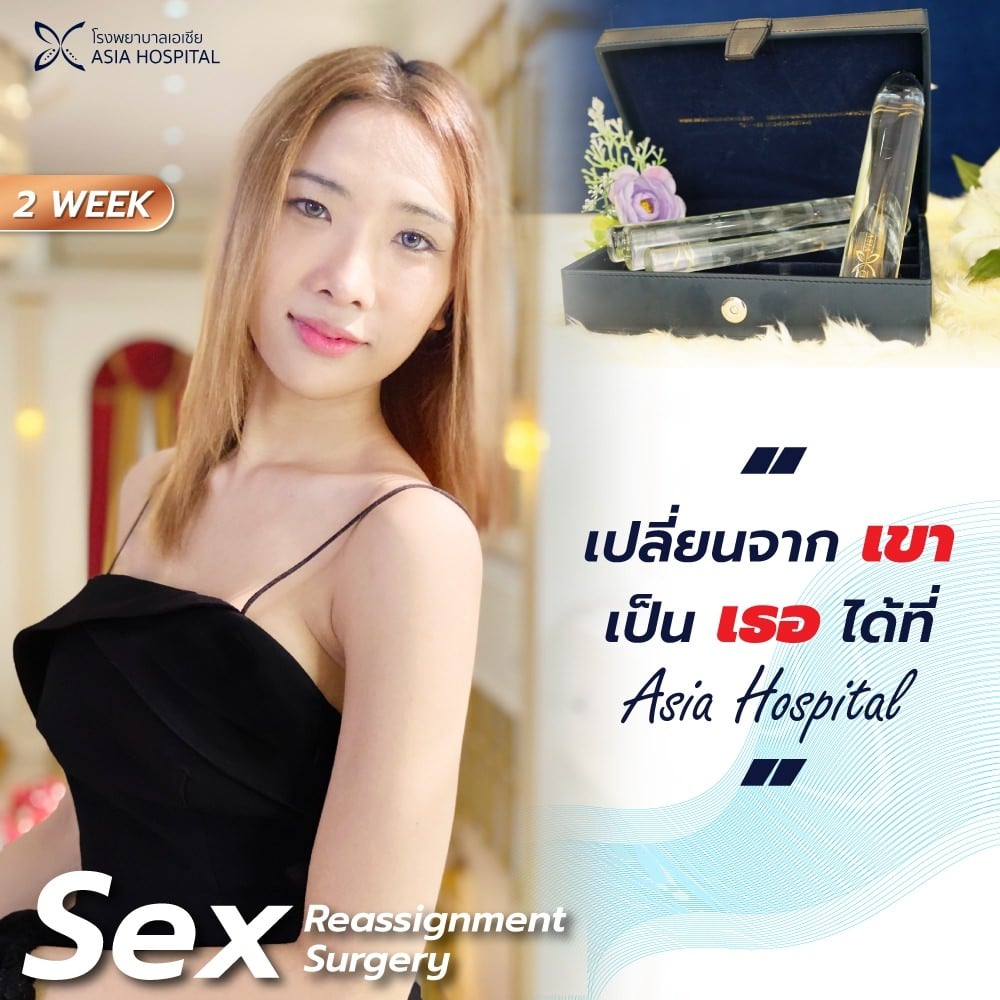 รีวิวแปลงเพศ-MTF