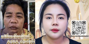 เปลี่ยนโฉมใหม่ คืนลมหายใจ และคืนชีวิตใหม่ ที่ โรงพยาบาลเอเซีย