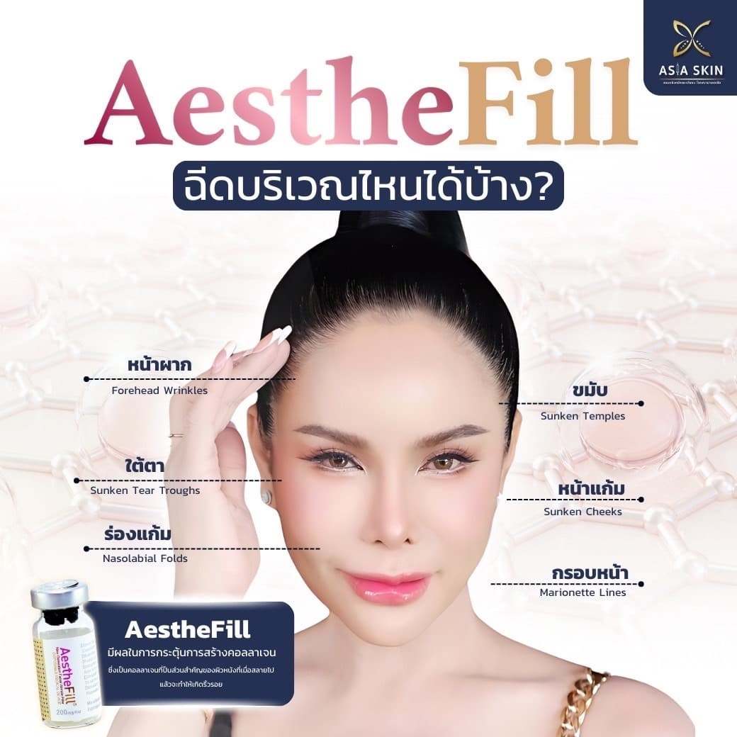 Aesthefill-แม่ลี