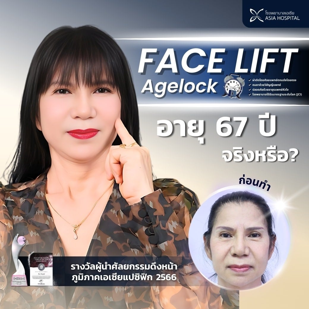 𝐅𝐚𝐜𝐞𝐥𝐢𝐟𝐭-ศัลยกรรมดึงหน้า