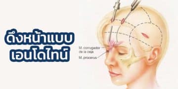 ดึงหน้าแบบปกติ กับ ดึงหน้าแบบเอนโดไทน์ต่างกันอย่างไร