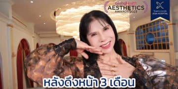 อัพเดตผลลัพธ์หลังดึงหน้า 3 เดือน