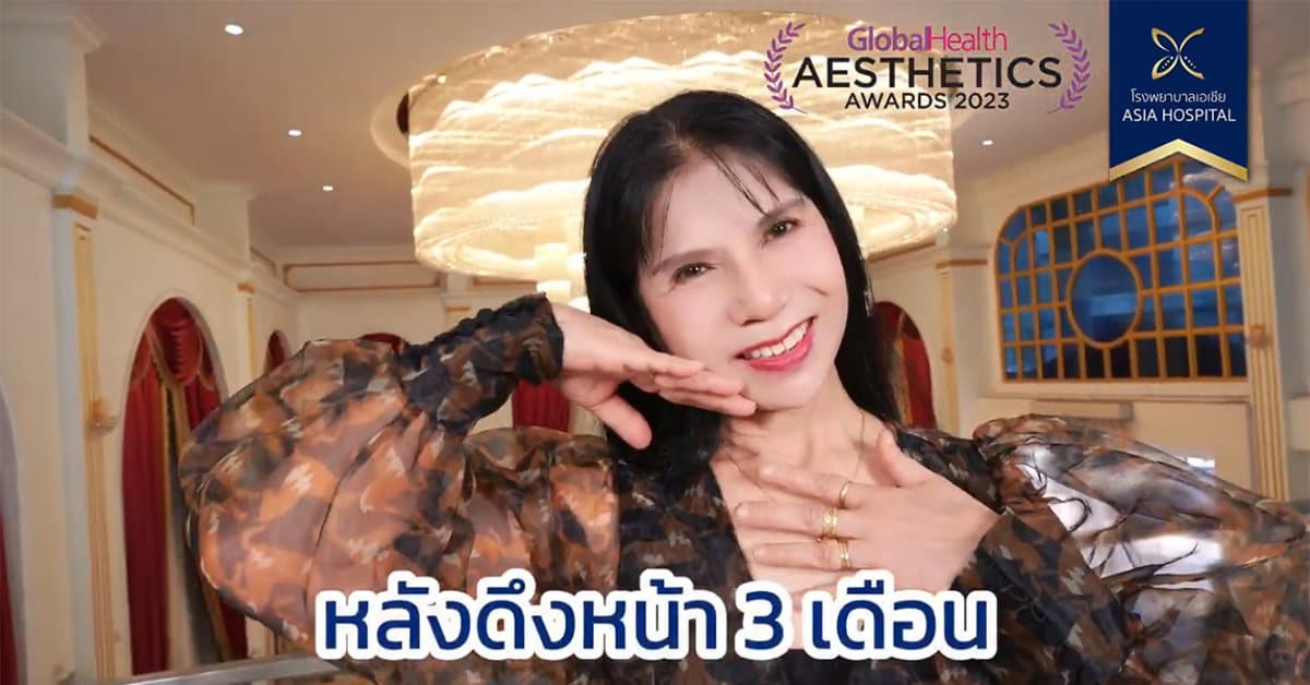 รีวิวหลังดึงหน้า