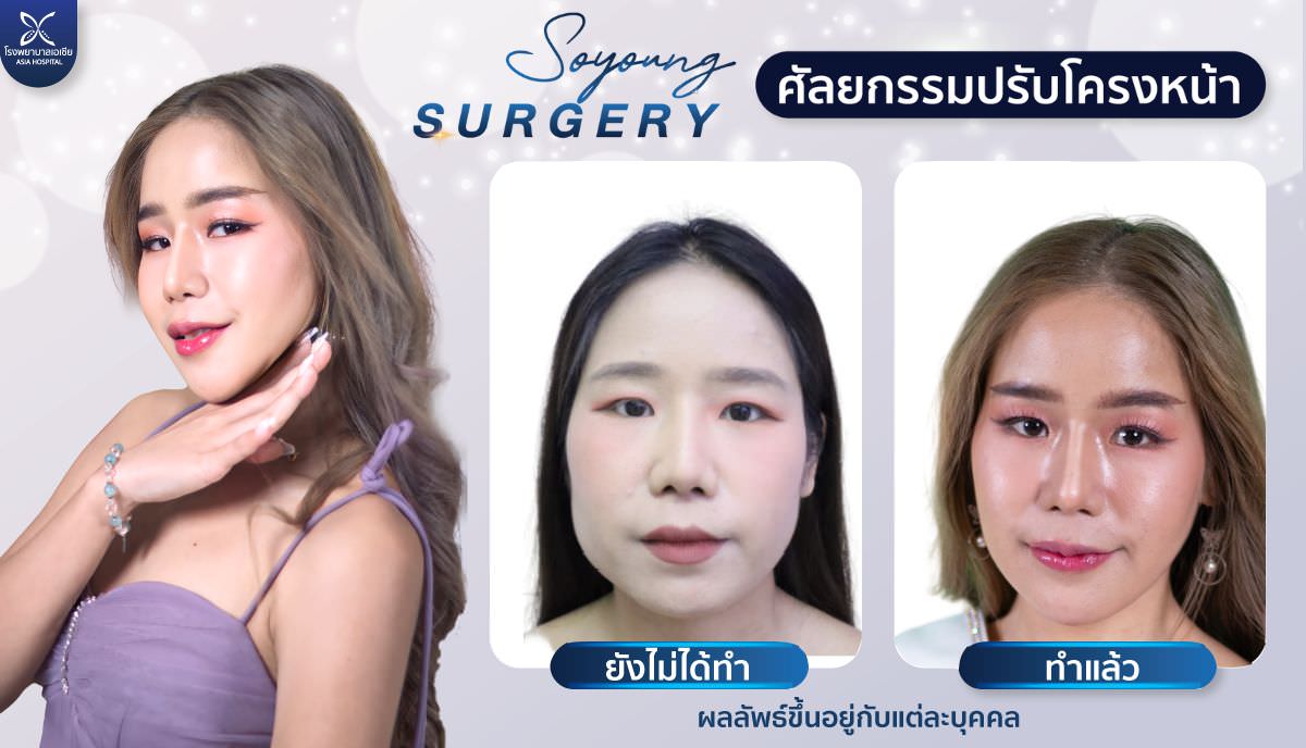 โรงพยาบาลเอเซีย_ตัดกราม_กรอกราม_วีไลน์