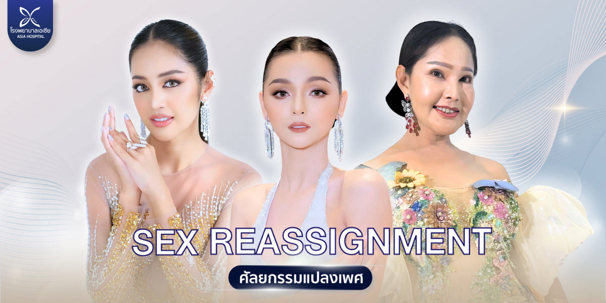 ศัลยกรรมแปลงเพศ