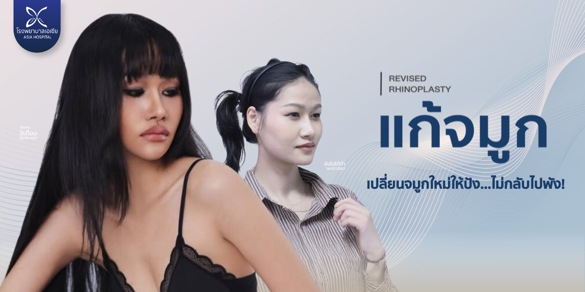 ศัลยกรรมแก้จมูก-รีวิวแก้จมูก-แก้ไขจมูก