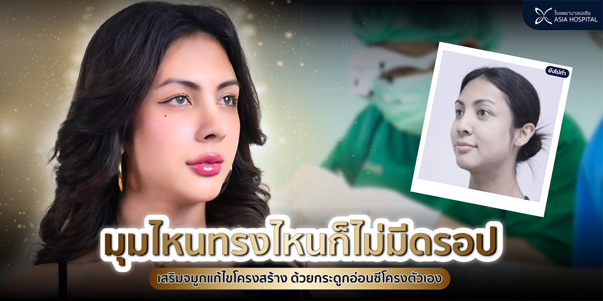 เสริมจมูกที่ไหนดี