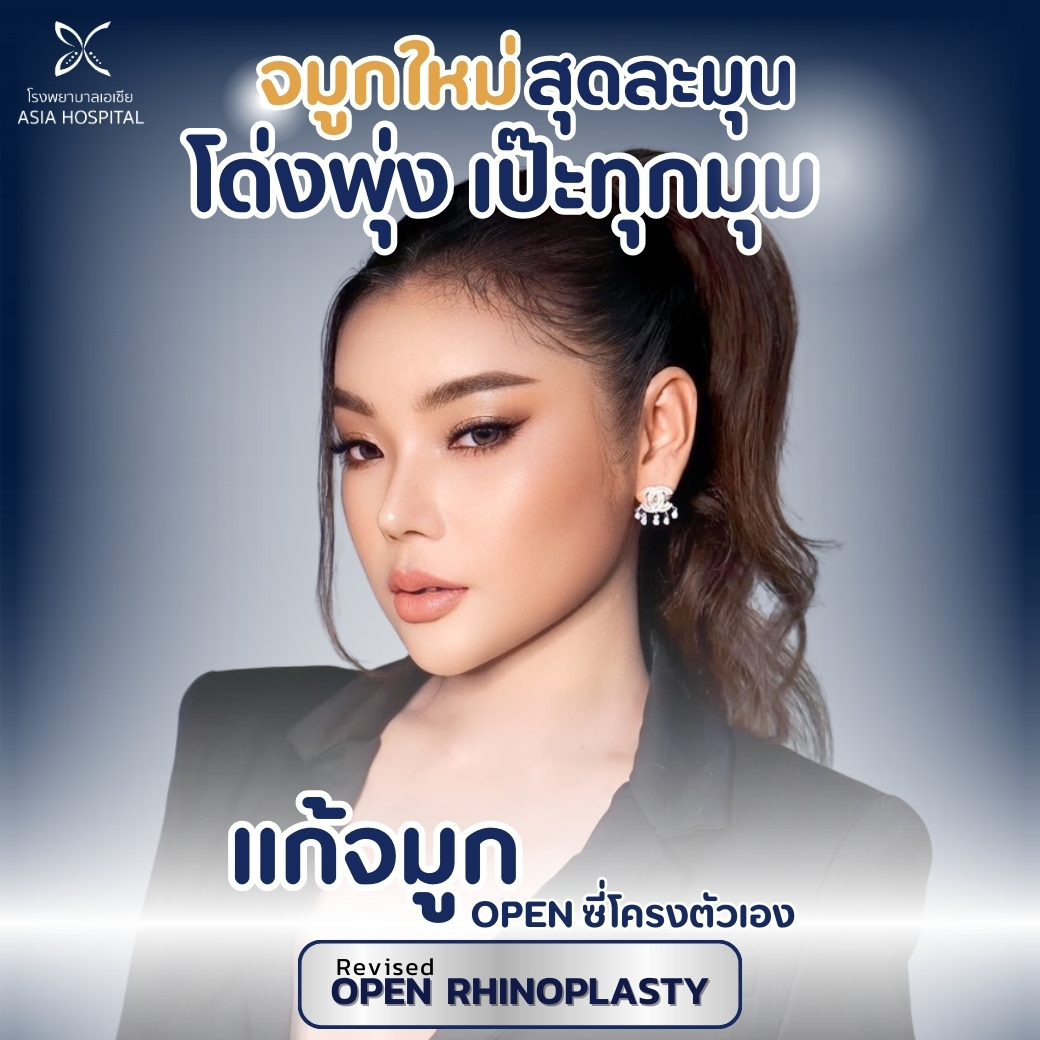 แก้จมูก open กระดูกซี่โครง